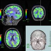 nuc_med_pet_scan