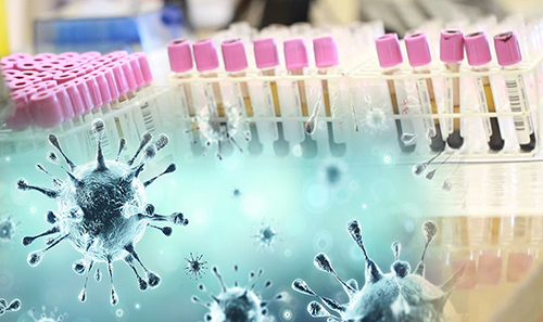 Corona virus in light blue color imposed over vials of blood in a lab for Clinicas Covid talk